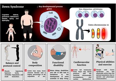 Resistance training and Down Syndrome: A narrative review on considerations for exercise prescription and safety